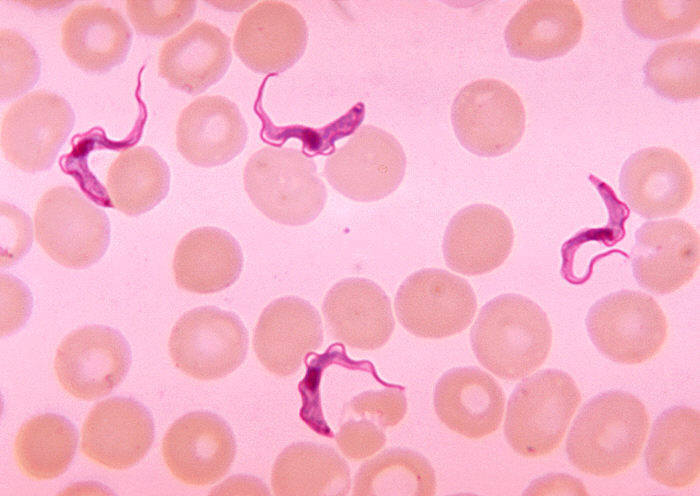 Microscopy image of trypanosomes among blood cells